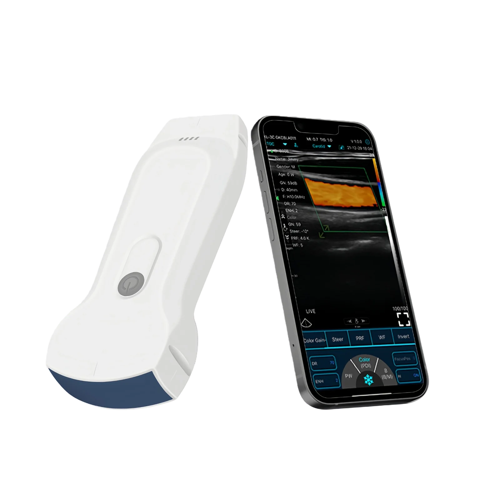 Comparing 'Standard' vs. 'DVA' modes in the latest Infrared Vein Viewer technology.